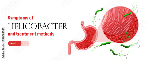 Web banner template with gastritis and helicobacter pylori. Healthcare vector illustration cartoon style