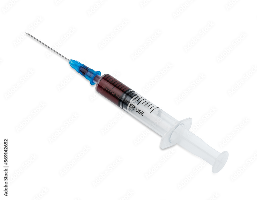 A syringe with blood for a blood test. Medical syringe with dark liquid. Drugs. Vitamins. Medicines. A syringe with blood for a blood test. Medical syringe with dark liquid. Drugs. Vitamins. Medicines.
