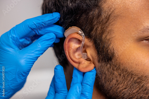 ENT doctor implementing hearing aid to the patients ear photo