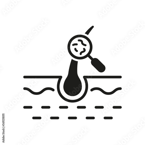 Hair Treatment Silhouette Icon. Lice Magnifying on Skin Glyph Pictogram. Health Care, Hygiene Head Skincare. Medical Problem in Hair Follicle Icon. Isolated Vector Illustration