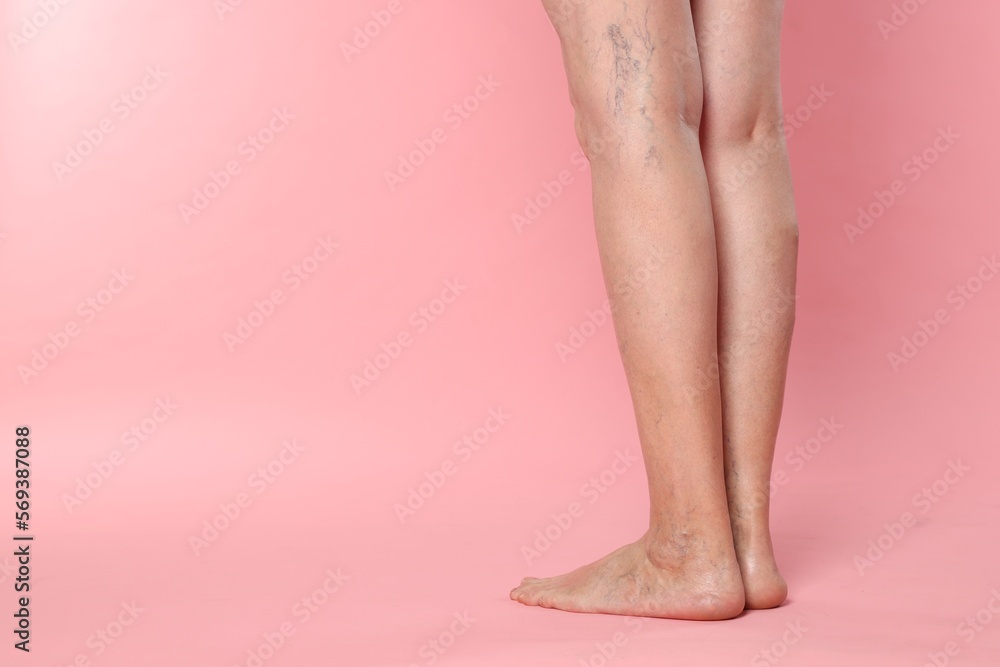 Closeup view of woman with varicose veins on pink background. Space for text Closeup view of woman with varicose veins on pink background. Space for text