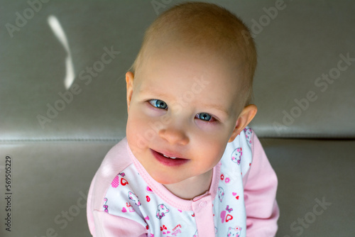 One little cute girl with red eyes after the operation. Portrait of smiling toddler girl. Red eyes