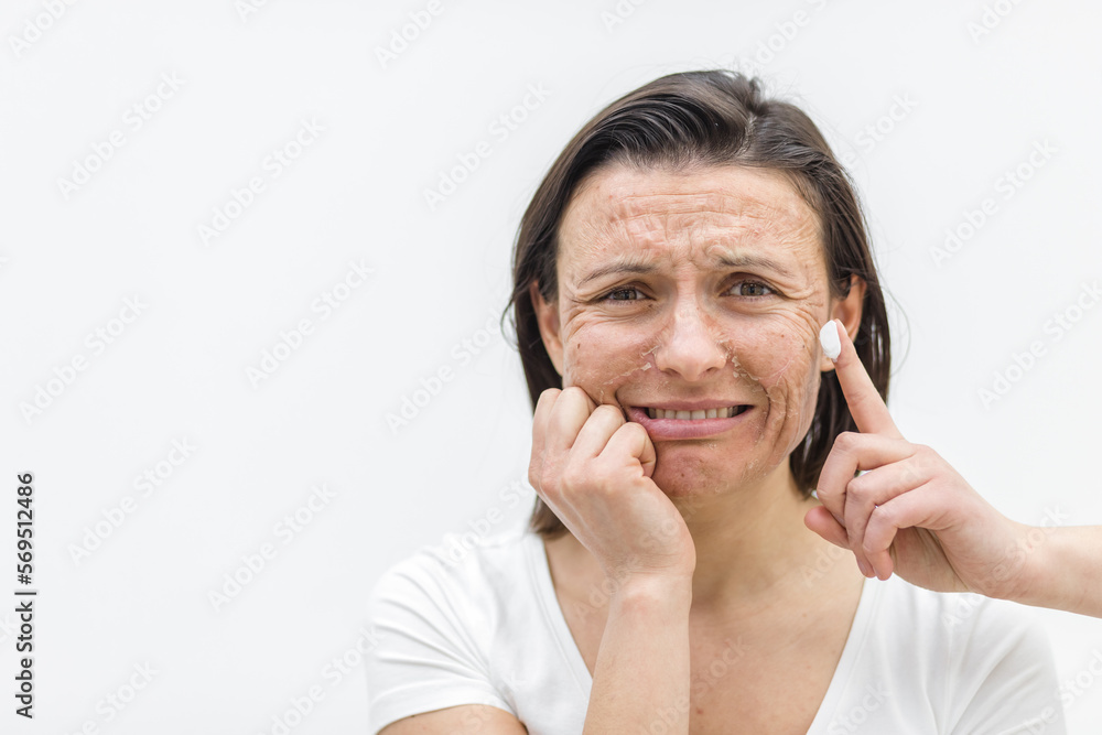 Photo of woman with dry skin and a finger in a cream. Photo of woman with dry skin and a finger in a cream.