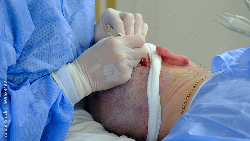 Fototapeta premium doctor operating on injured man. doctor treating injured man