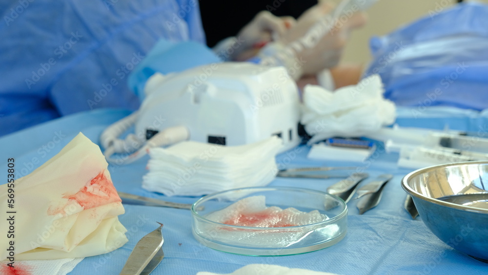 teamwork of doctors during surgery. doctors during surgery teamwork of doctors during surgery. doctors during surgery