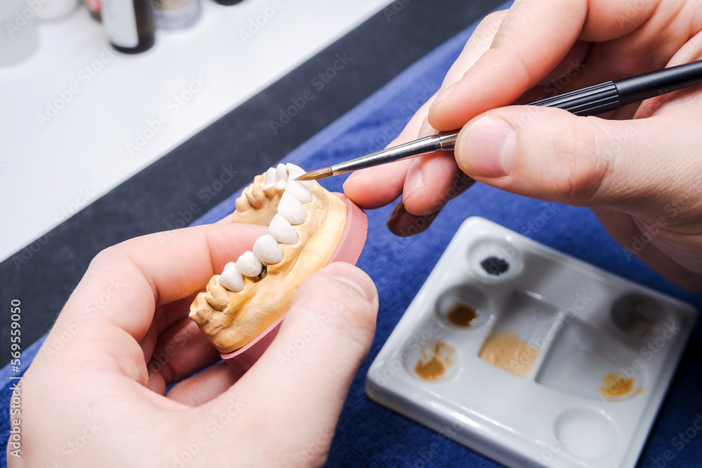 Dental technician or dentist working with tooth dentures model in his laboratory. Prosthetic dentistry technician working in his office