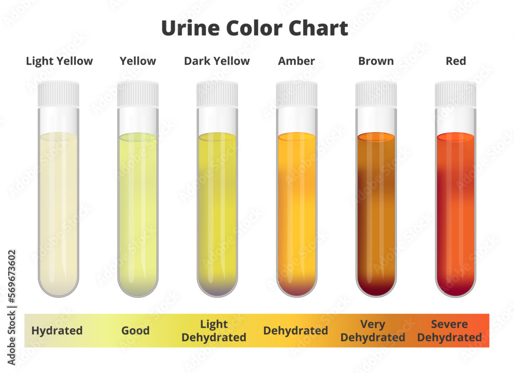Poster Urine Color Chart Wall Art UkPosters