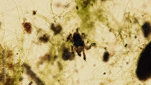 marine halacarid mite (Arthropoda of Order Prostigmata Family Halacaridae) from a reef aquarium under the microscope - light microscope x100 magnification photo