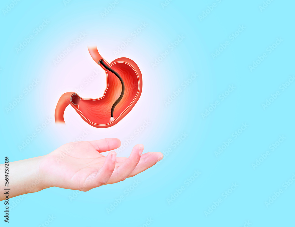 Endoscopic biopsy, esophagogastroduodenoscopy, EGD. Human stomach isolated on light blue