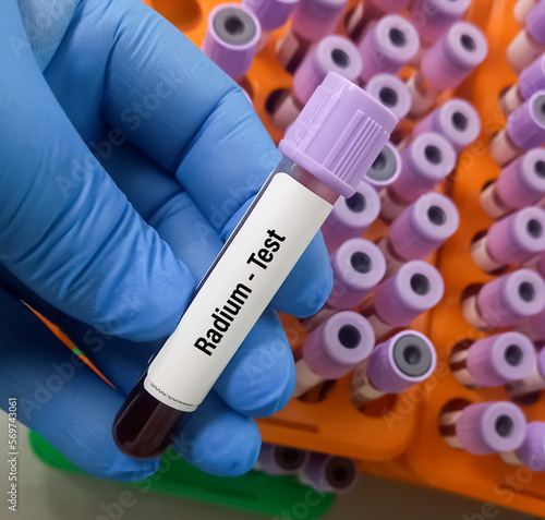 Quadro su tela Blood sample for Radium (heavy metal) test, toxic metal