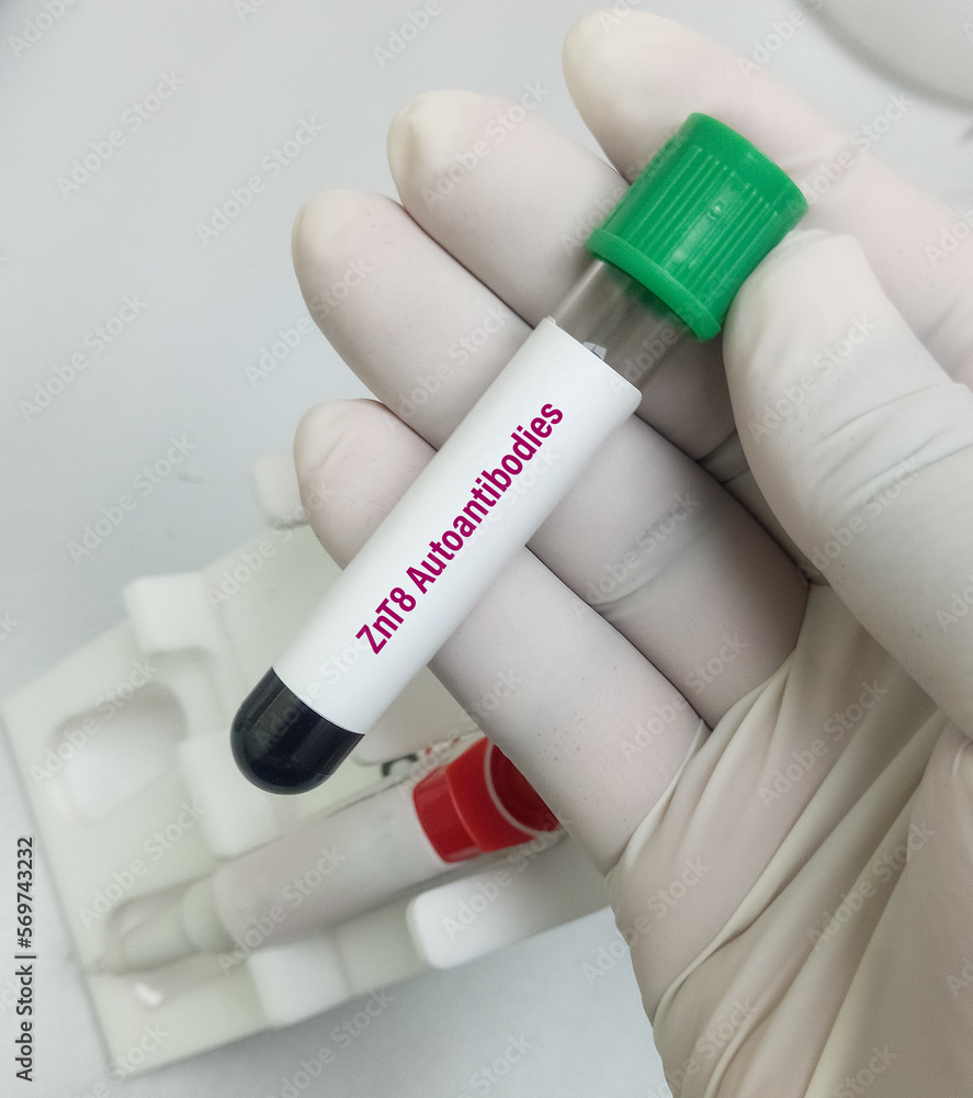 Blood sample for Zinc Transporter 8 (ZnT8) antibody test to