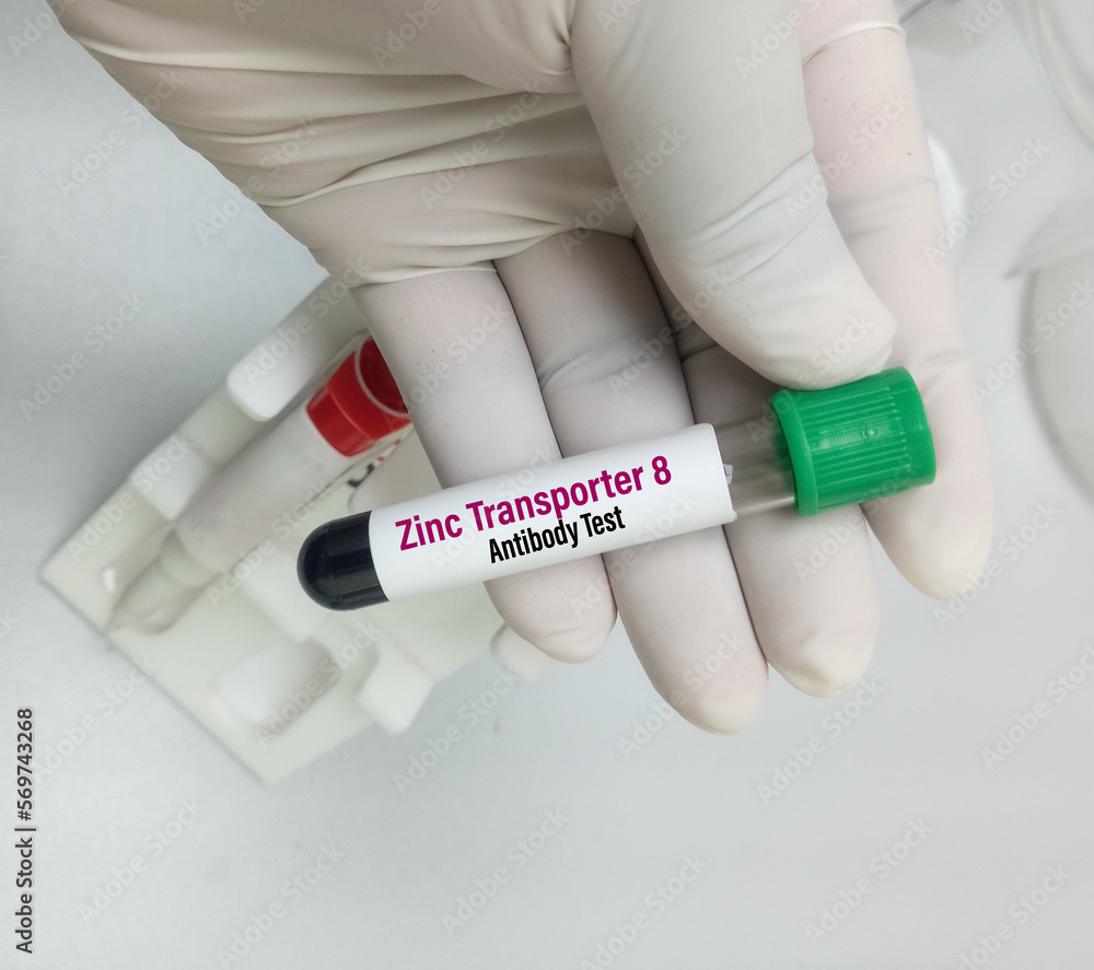 Blood sample for Zinc Transporter 8 (ZnT8) antibody test to