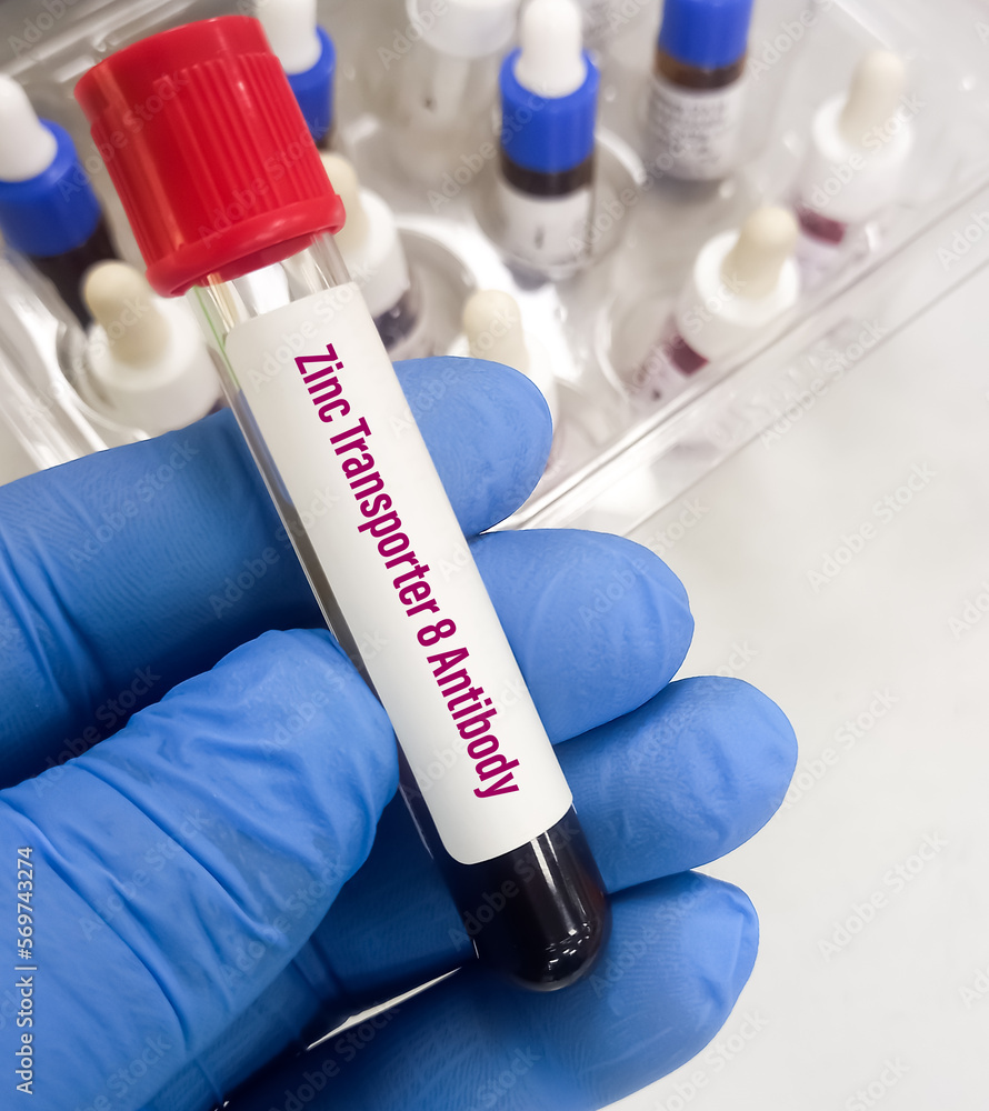Blood sample for Zinc Transporter 8 (ZnT8) antibody test to