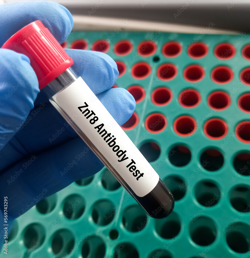 Blood sample for Zinc Transporter 8 (ZnT8) antibody test to