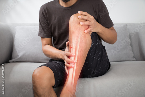 A man with a shinbone Fracture in an accident. photo