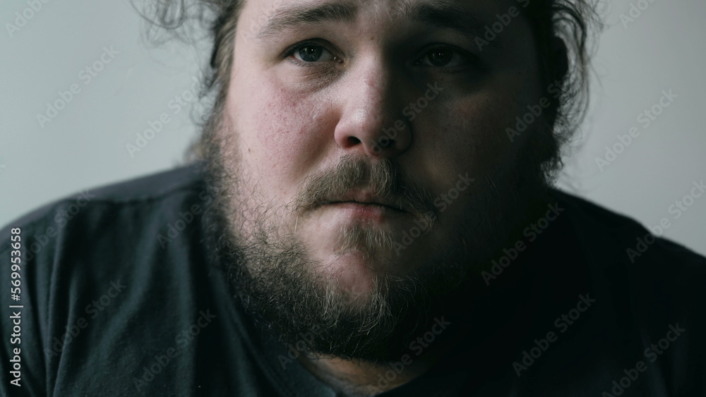 Preoccupied man suffering from mental pain. Close up face of a worried person with anxious expression. Emotional disorder concept Preoccupied man suffering from mental pain. Close up face of a worried person with anxious expression. Emotional disorder concept