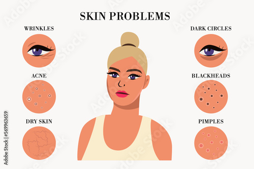 sad woman and set of most common female facial skin problems needs to care about: acne, pimples, wrinkles, dry skin, blackheads, dark circles under eyes. vector infographic