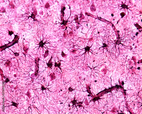 Cerebral cortex. Protoplasmic astrocytes photo