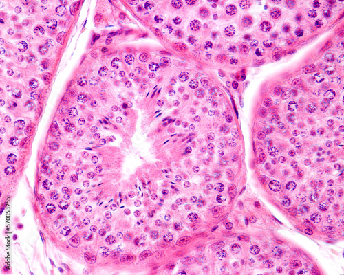 Human testicle. Seminiferous tubules photo
