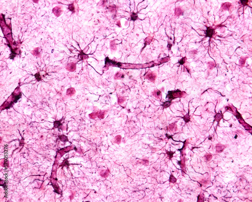 Cerebral cortex. Protoplasmic astrocytes photo