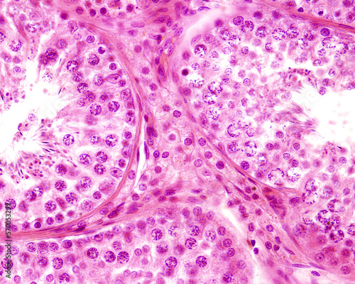 Human testicle. Leydig cells photo