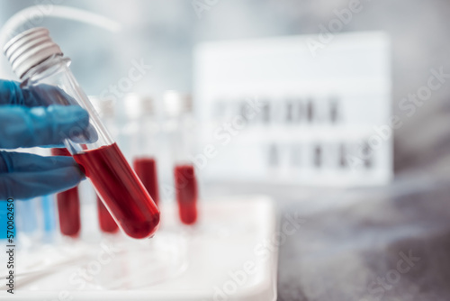 Hand holding blood test sample tube - Laboratory concept