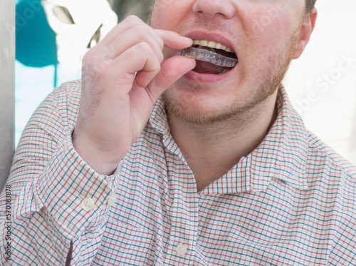 A person puts a plastic aligner plate on his teeth from brcusism, a cap for aligning his teeth or an aligner. The concept of healthy teeth in men photo