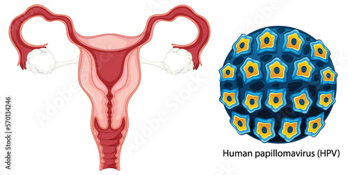Vaginal infection bacteria concept
