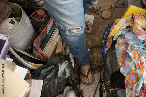 closeup leg of a person with hoarding disorder.
