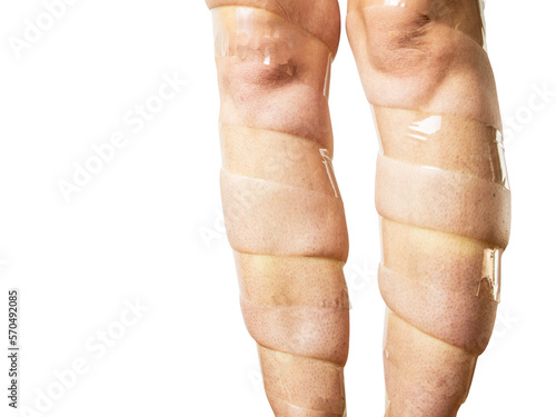 concept of varicose veins, female legs are taped, on a white background, heaviness and discomfort in the leg, leg fatigue when wearing high heels, photo