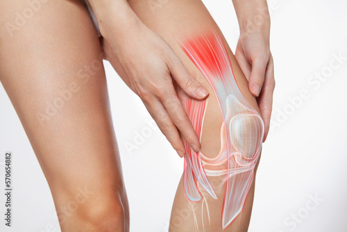 Knee ligament and meniscus, human leg, medically accurate representation of an arthritic knee joint	
