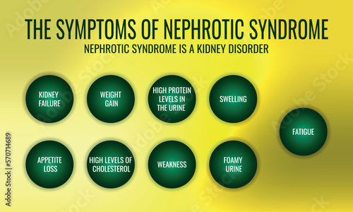 the Symptoms of Nephrotic syndrome. Vector illustration for medical journal or brochure.