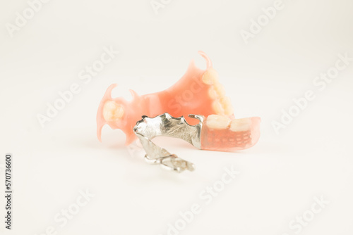 removable dental prostheses