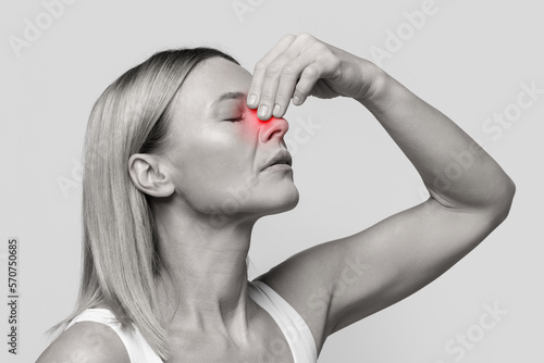 Tableau sur toile Middle aged woman suffering from nasal bleeding, closeup