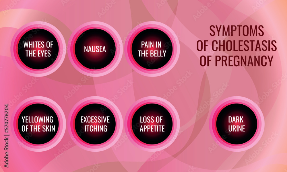 symptoms of Cholestasis of pregnancy. Vector illustration for medical journal or brochure. Stock