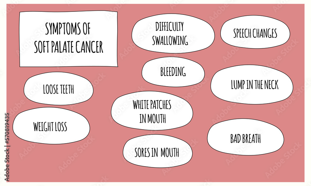 Soft Palate Bruise Symptoms Causes When To See A Doctor - lf65ha0