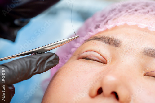 Foto Cosmetic procedure for changing the shape of the eyes, lifting and strengthening the skin of the eyelids