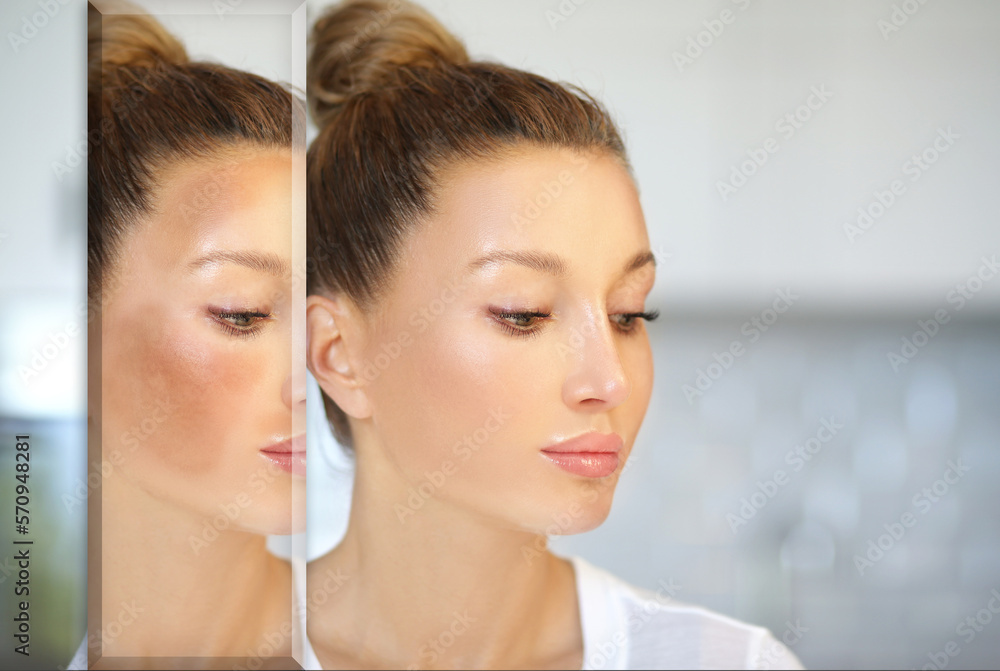 Dark spots, freckles,hyperpigmentation(melasma or chloasma),concept - skin lightening, skin whitening, fruit acids,AHA, Skin Brightening Dark spots, freckles,hyperpigmentation(melasma or chloasma),concept - skin lightening, skin whitening, fruit acids,AHA, Skin Brightening