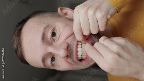 Vertical video. Young man pulls orthodontic rubber band on his teeth to correct his bite. Dental concept. Isolated