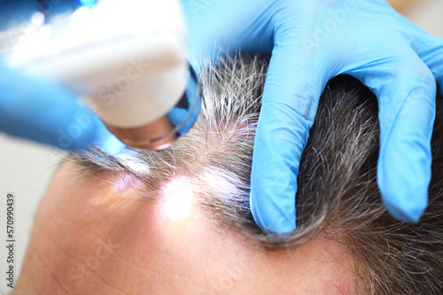 A cosmetologist-trichologist diagnoses the condition of a male patient's hair with gray hair using a trichoscope. photo