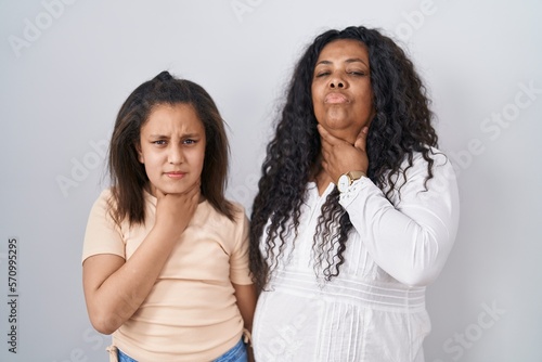 Mother and young daughter standing over white background touching painful neck  sore throat for flu  clod and infection