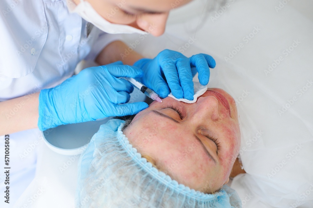 cosmetologist makes a mesotherapy or plasmolifting procedure for the patient. Biorevitalization is a method of preventing skin aging by microinjections of hyaluronic acid. cosmetologist makes a mesotherapy or plasmolifting procedure for the patient. Biorevitalization is a method of preventing skin aging by microinjections of hyaluronic acid.