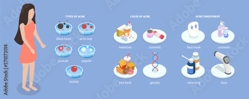 3D Isometric Flat Vector Conceptual Illustration of Oily Skin Problems, Skin Care and Treatment