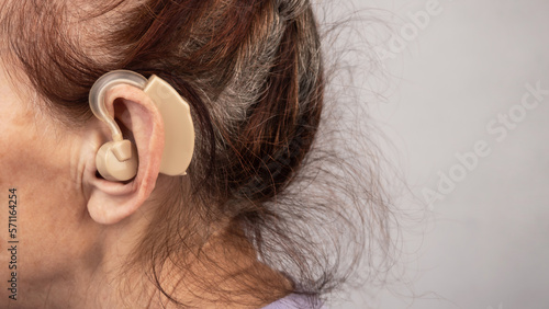 Hearing aid. Close-up of an old woman with a hearing aid in her ears. Medicine concept.