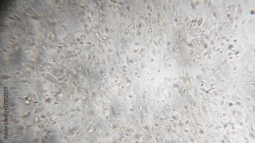 Slow motion filming of the movement of active spermatozoa under a microscope. Sperm bank. reproductive function of man. The survival of all mankind