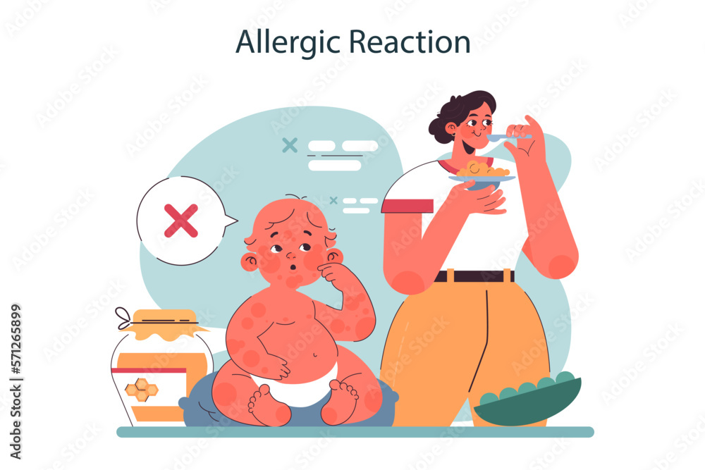 Obraz premium Allergic reaction on a breast milk. Nursing mother diet. Foods to avoid during