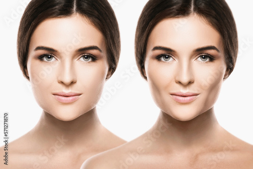 Female face comparison after buccal fat extraction plastic surgery photo