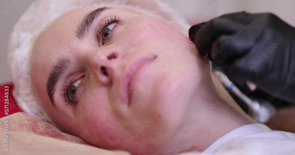 Close-up shot of a woman in a bright cosmetology room during a rejuvenating procedure with syringe injections in the face Close-up shot of a woman in a bright cosmetology room during a rejuvenating procedure with syringe injections in the face