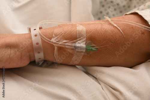 catheter needles in a patient's arm