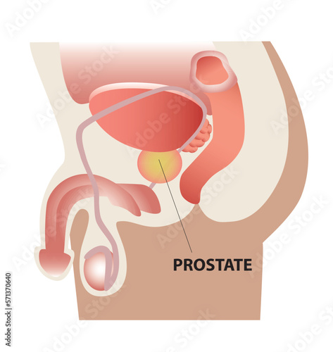 Prostate - Próstata